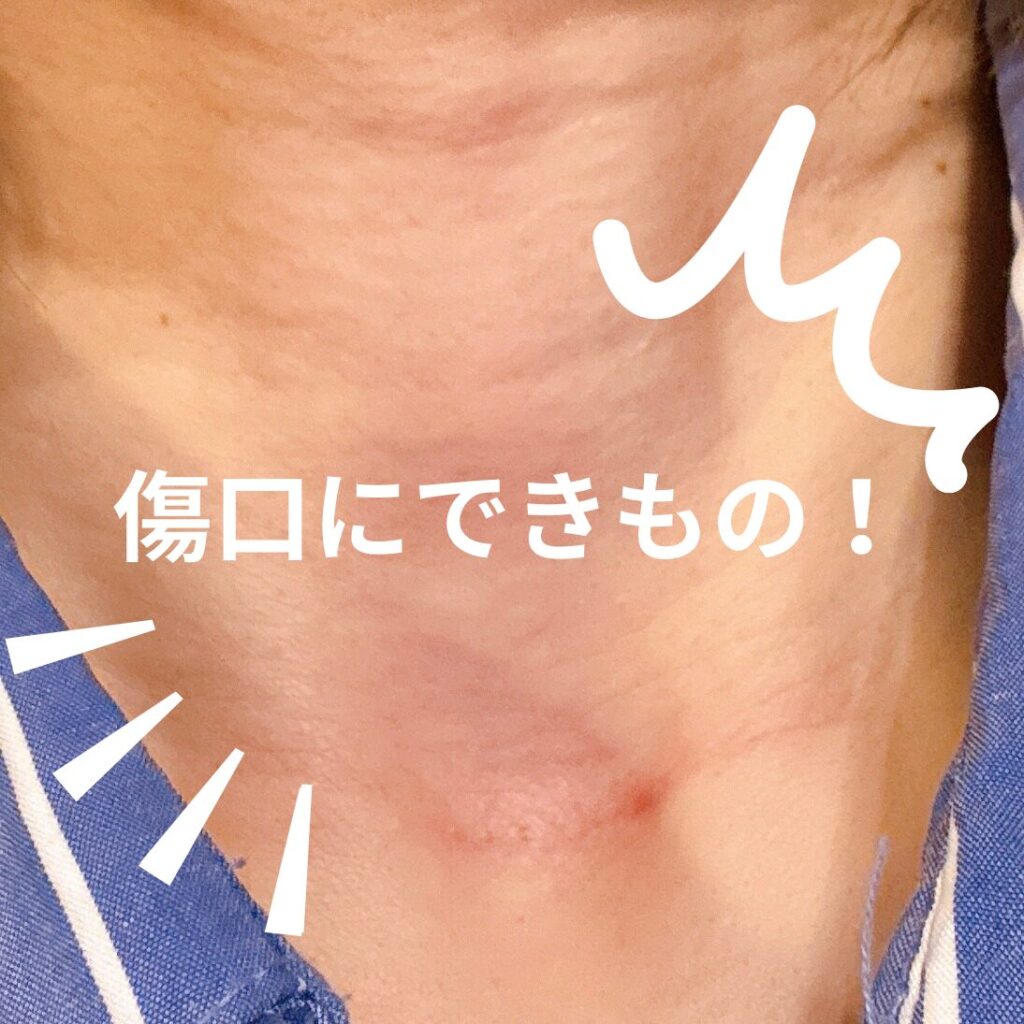 傷口にできもの